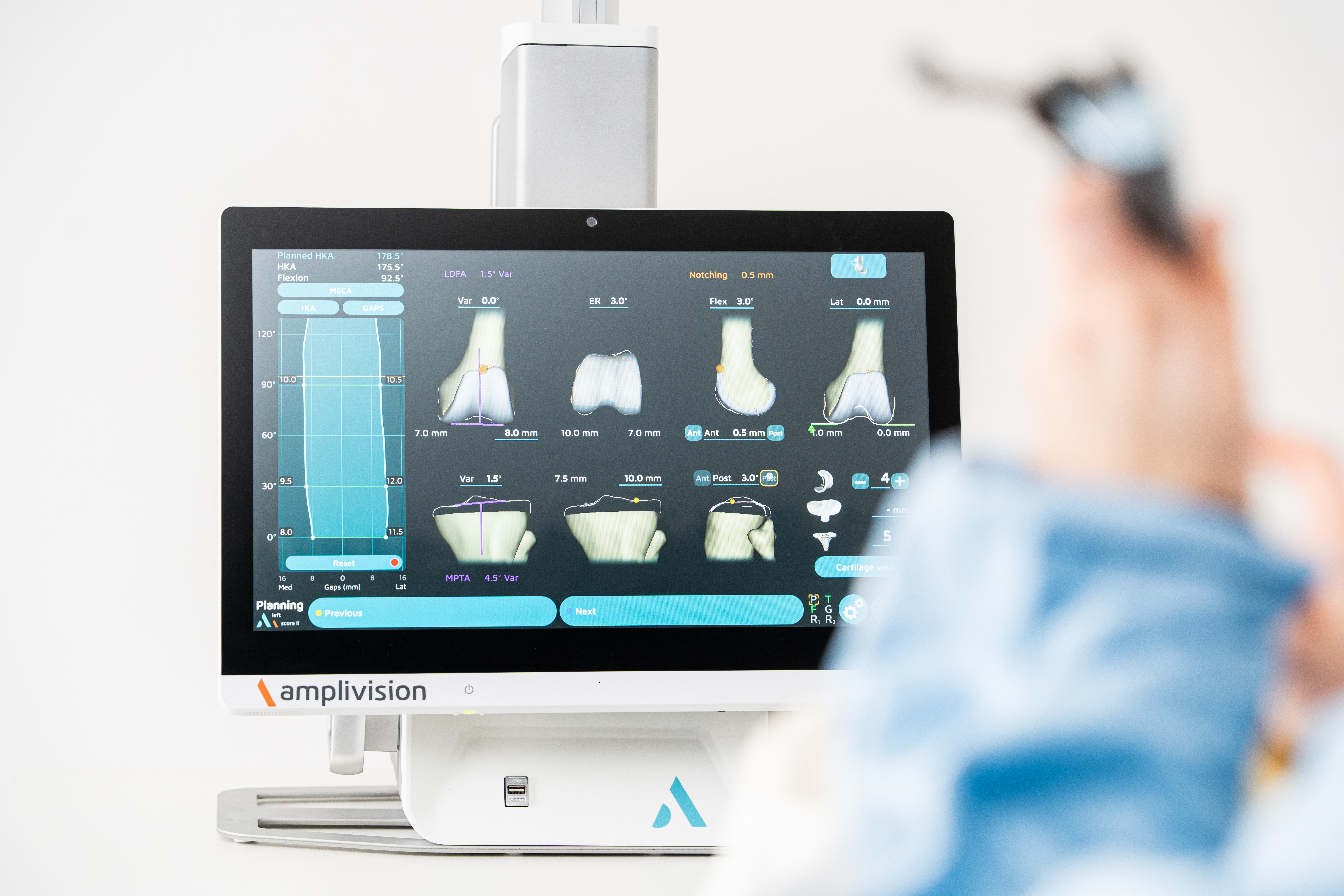AMPLIVISION