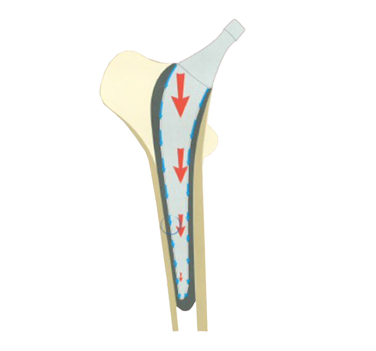 Revision INITIALE-3