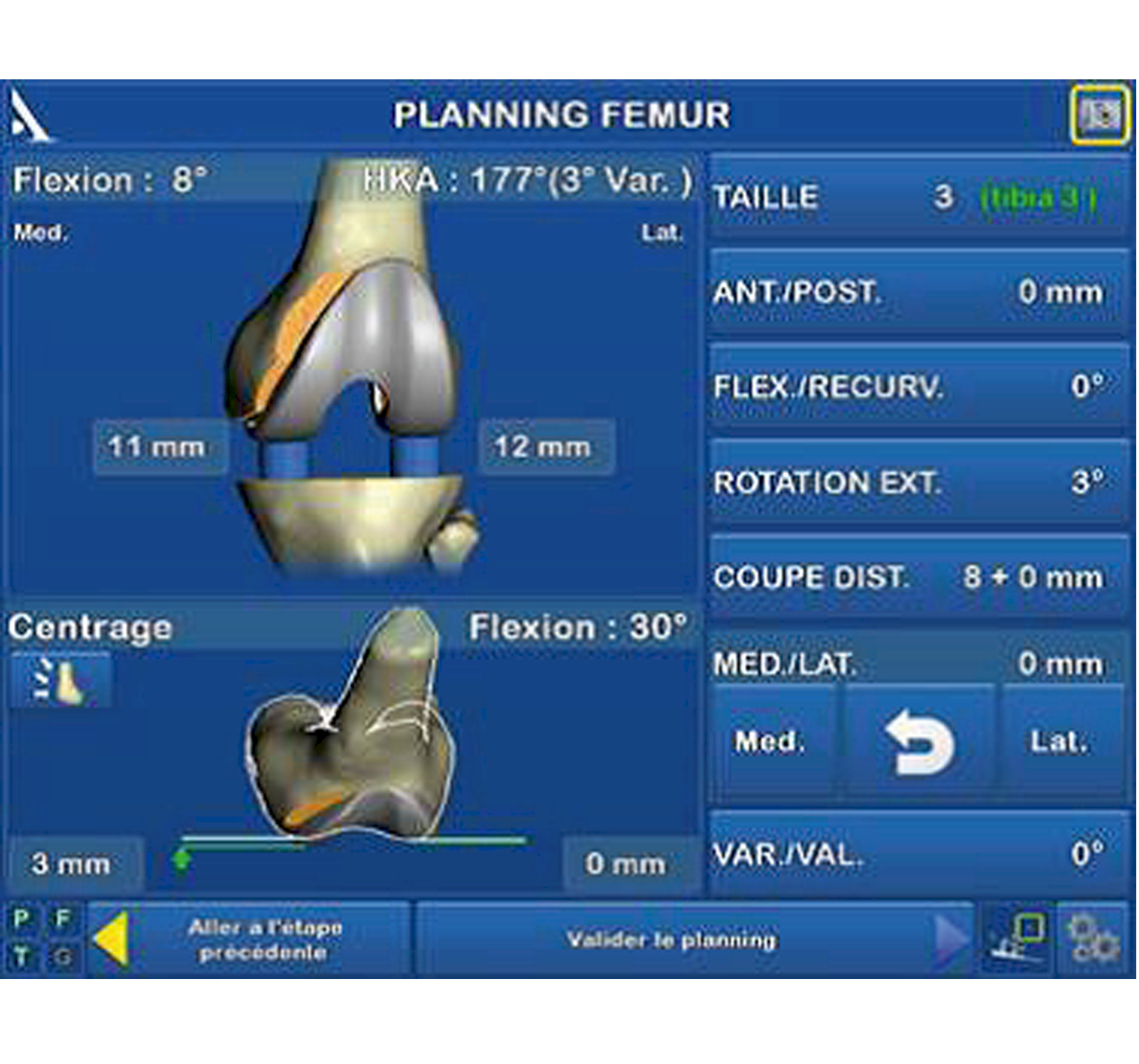 AMPLIVISION®-4 AMPLIVISION®-4